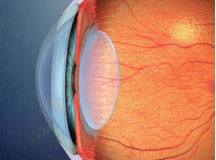 Eye with clear crystalline lens