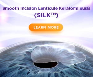 smooth incision lenticule keratomlleusls