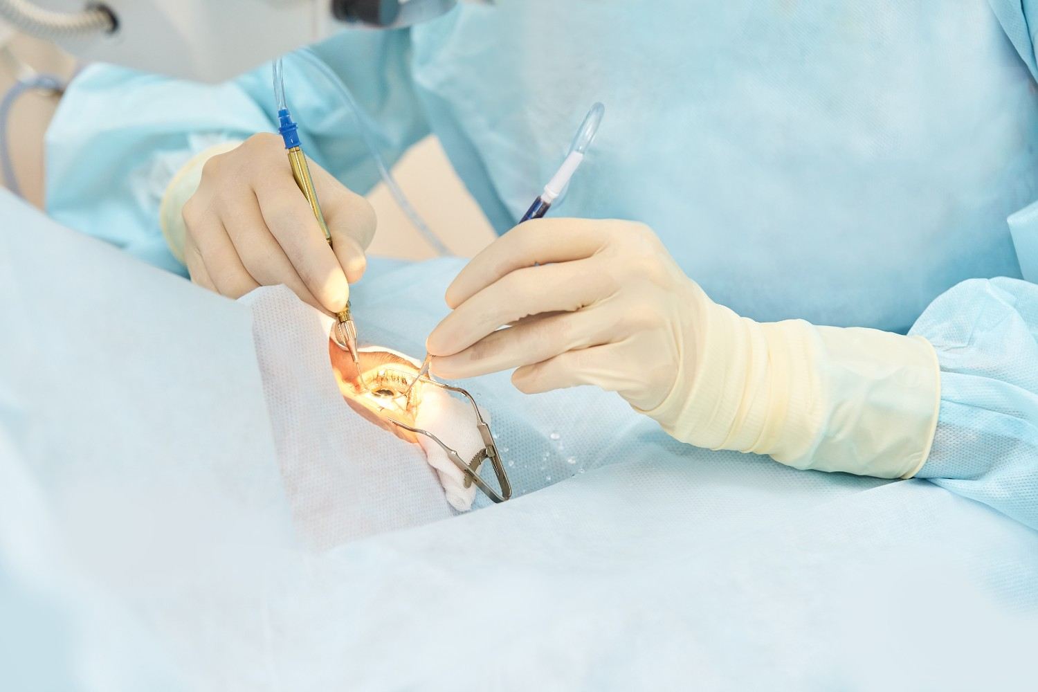 Ophthalmologist discussing eye surgery options with patient