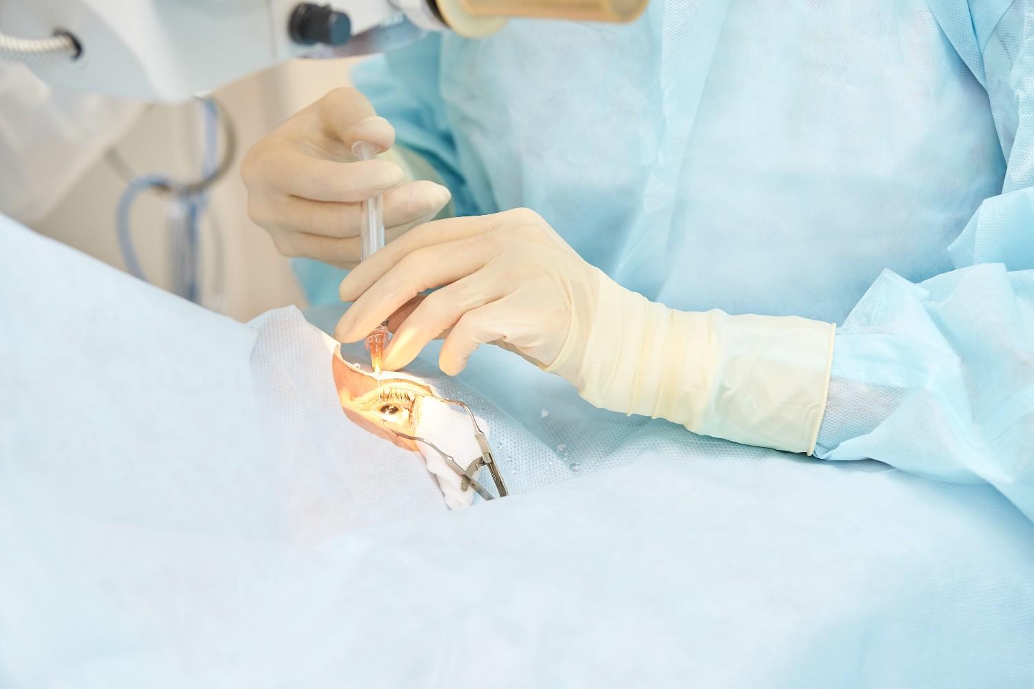 Cataract Surgery