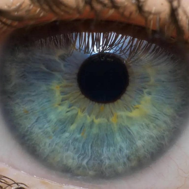 Cataract SIngapore