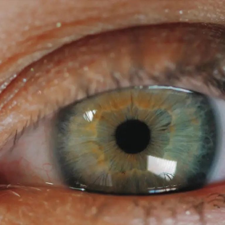 implantable-contact-lens-singapore