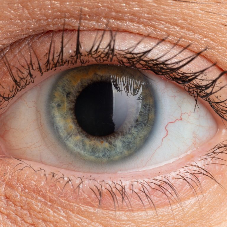 woman-s-blue-pupil-close-up-2023